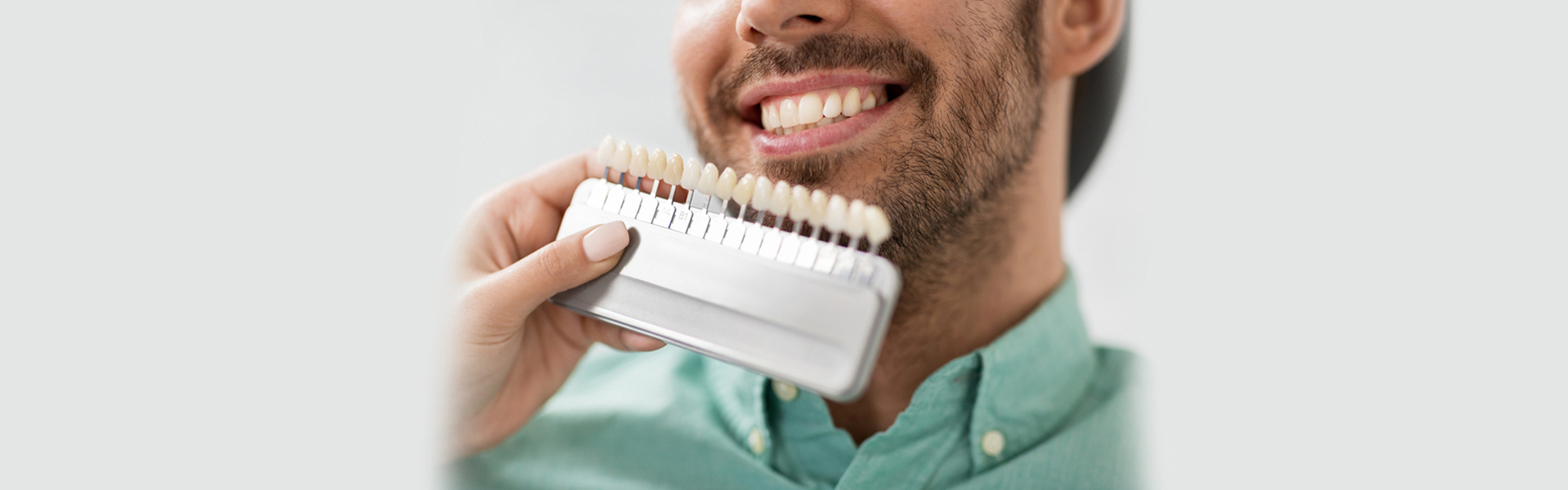 Veneers: How to Maintain Them and Keep Them Looking Like New