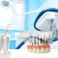 Five Common General Dentistry Services